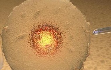 去北京做三代试管婴儿多少钱啊？